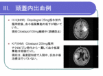 脳出血合併例.GIF
